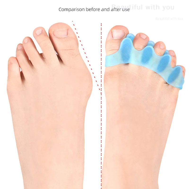 Separador de dedos do pé, corretor de valgo flexível, alivia o polegar, cuidados com os pés