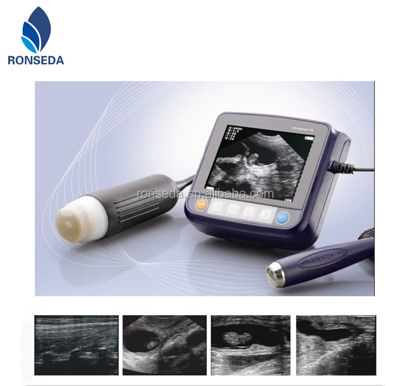 Portable Ultrasonic Diagnostic Devices Type Portable Ultrasound scanner for Pets and Animal