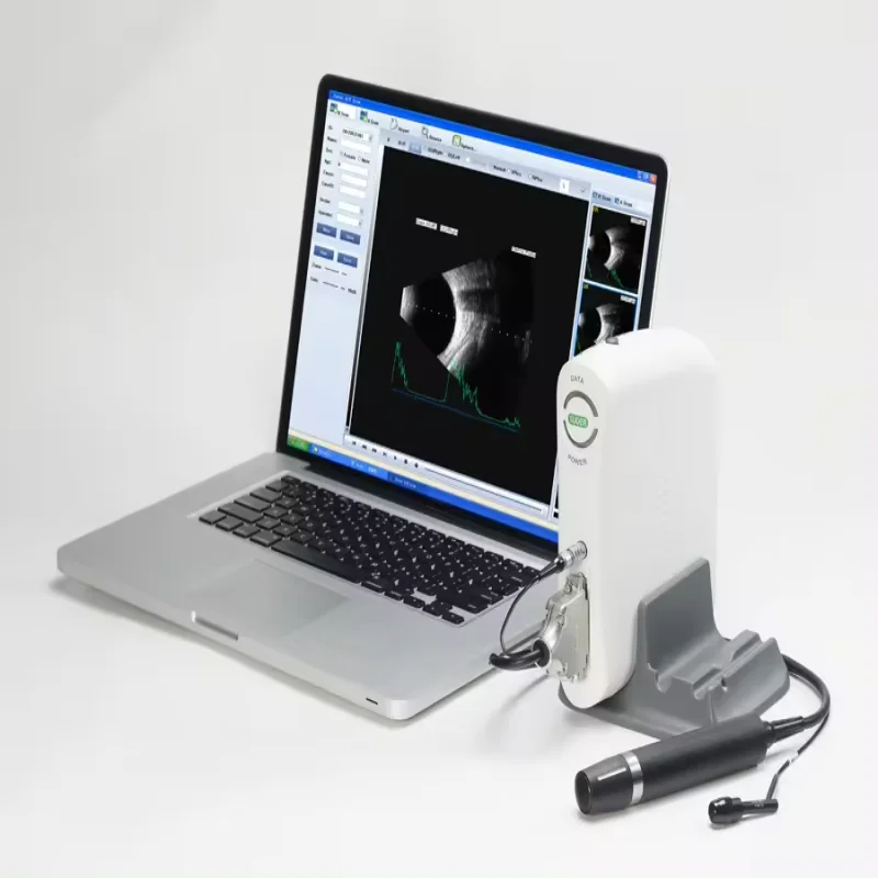 Sw-2100 Medical Eye Measurement Ophthalmic Ultrasound A/b Scanning Optical Biometer