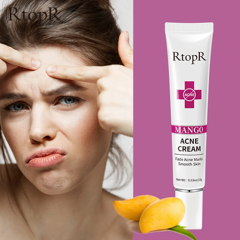 

Herbal Face Cream Treatment Fade Fine Lines Shrink Pores Acne Repair Cream Plant Extract Moisturizing Lightening Skin Care