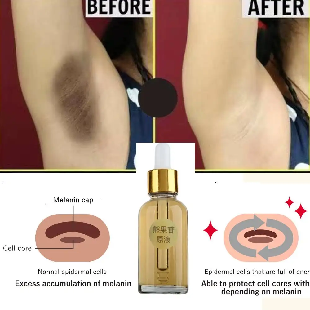 

Dark Spot Corrector - Underarm Serum for Armpit, Elbows, Knees, Neck , Private Areas - Dark Spots Oil