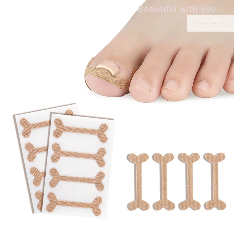 1 Set Toenail Corrector Tools Pedicure Recover Embed Toe Nail Treatment Professional Foot Care Correction Tool