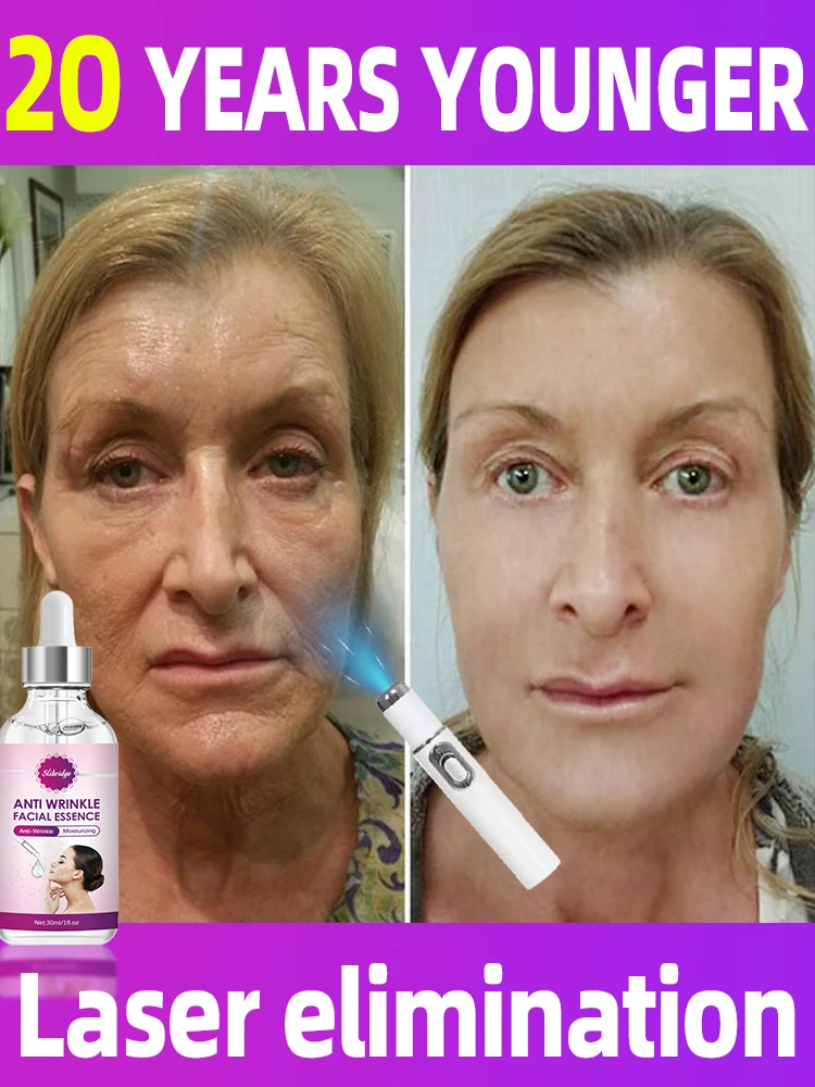 Solve all facial wrinkle problems