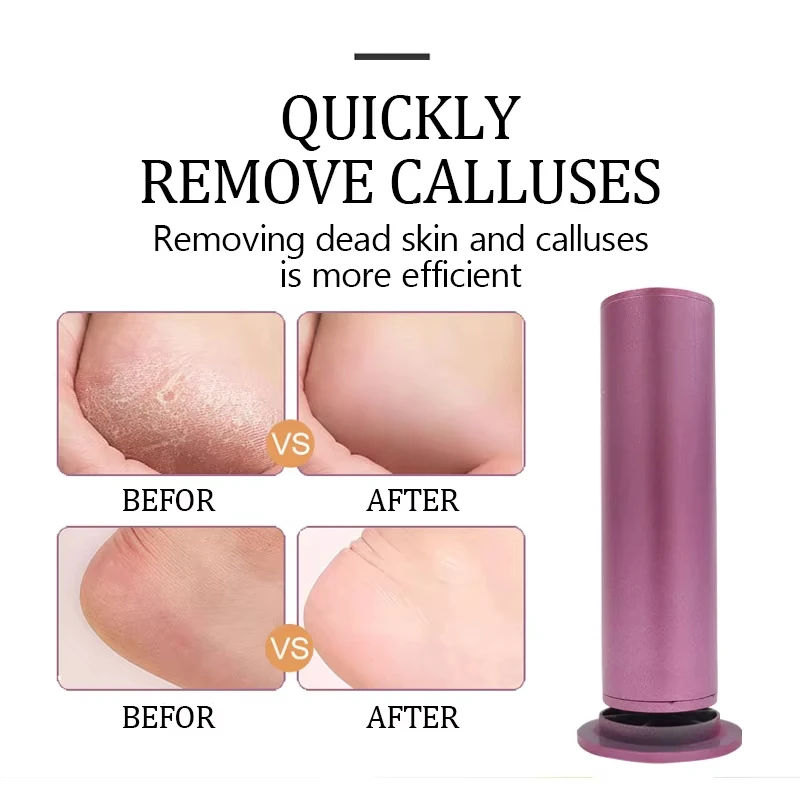 Electric Foot Callus Remover USB Wired Adjustable Speed Pedicure Tool Professional Dead Skin Eraser for Home Foot Care - view 6