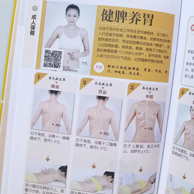 Schröpfen Gesundheit Körper Entfernung Buch Illustrierte TCM Akupunkturpunkt Null-basierte Schröpfen Einführung Schröpfen Technik Tutorial
