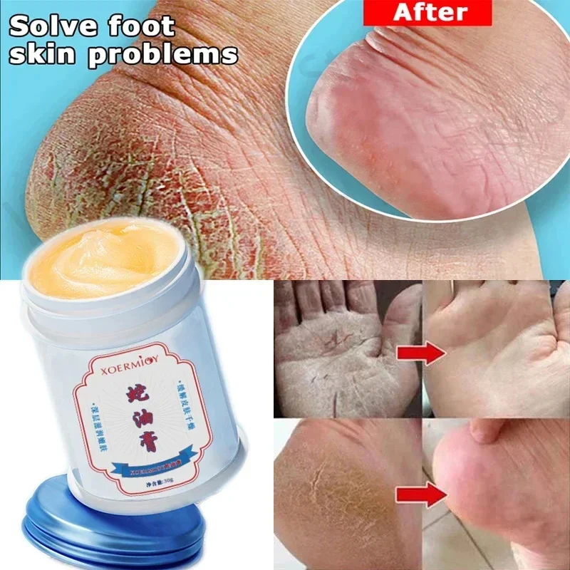 30g Herbal Anti Crack Foot Cream Heel Crack Repair Products Exfoliating Dead Skin Removal Softening Moisturising Skin Care