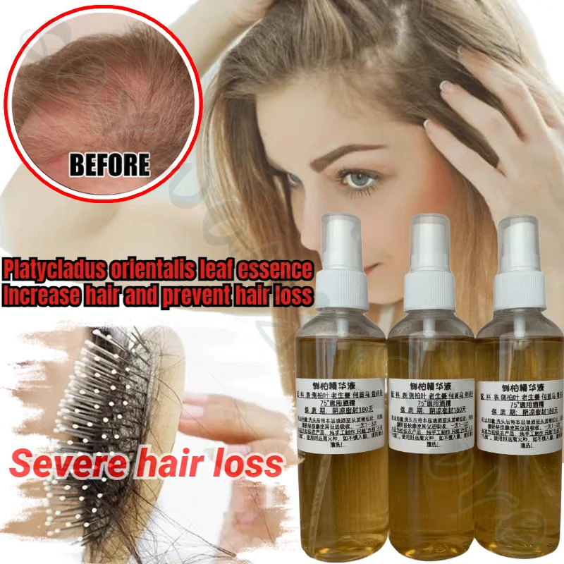 Platycladus Orientalis Leaf Essence Is A Pure Natural Plant Extract That Nourishes, Prevents and Reduces Hair Loss 100ml