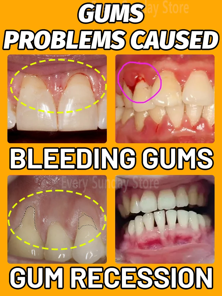 Save gums