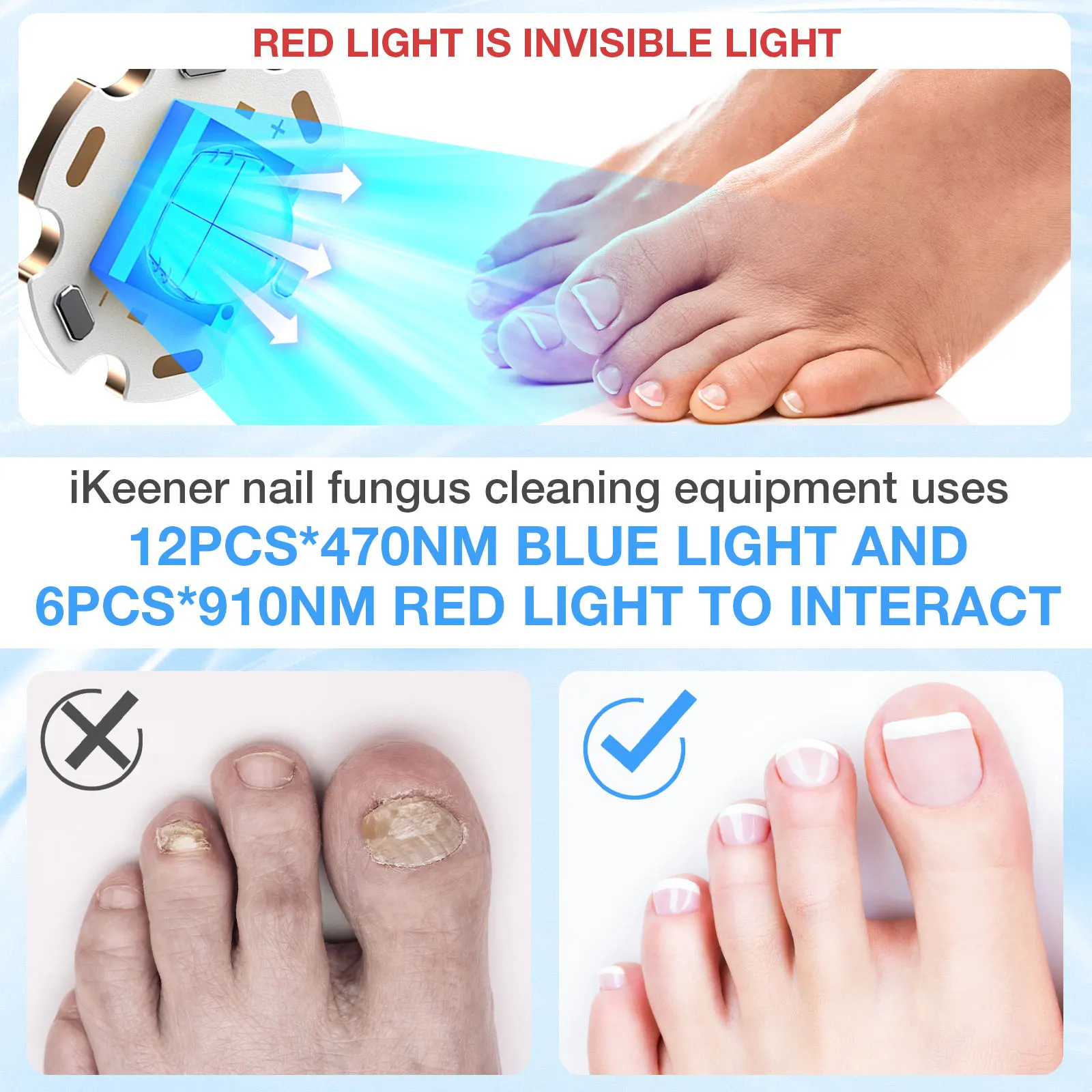 KTS Semi-arc Nail Fungus Laser Device 12x470nm 6x910nm Cure Onychomycosis Toenail Fingernail Fungal Therapy Time display 2000mA