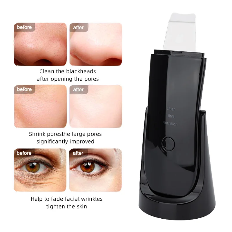 Professional No Ultrasonic Facial Skin Scrubber Ion Deep Face Cleaning Peeling Rechargeable Skin Care Device Beauty Instrument