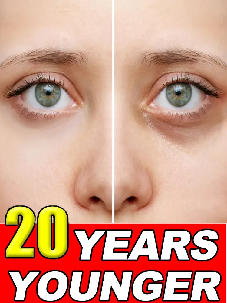 

Eye Care 20 Years Younger