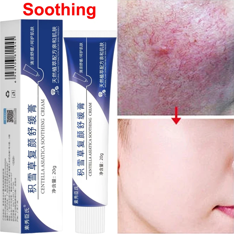 Instant Facial Redness Repair Cream Soothing Red Blood Rosacea Treatment Improve Sensitive Skin Moisturizer Skin Care Cosmetics