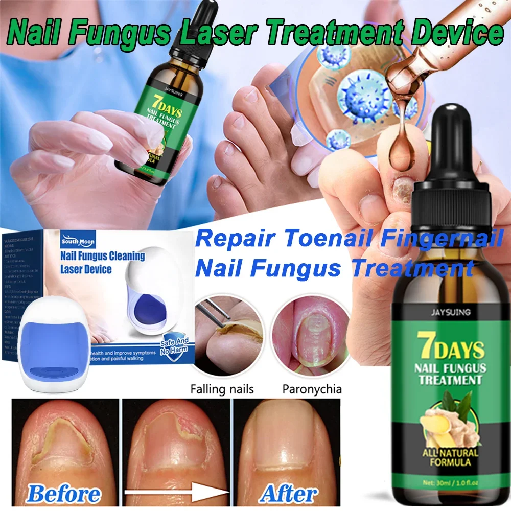 

Nail Fungus Treatment Device Foot Toe Nails Fungal Repair Serum Anti Infection Gray Nails Onychomycosis Paronychia Remove Tools