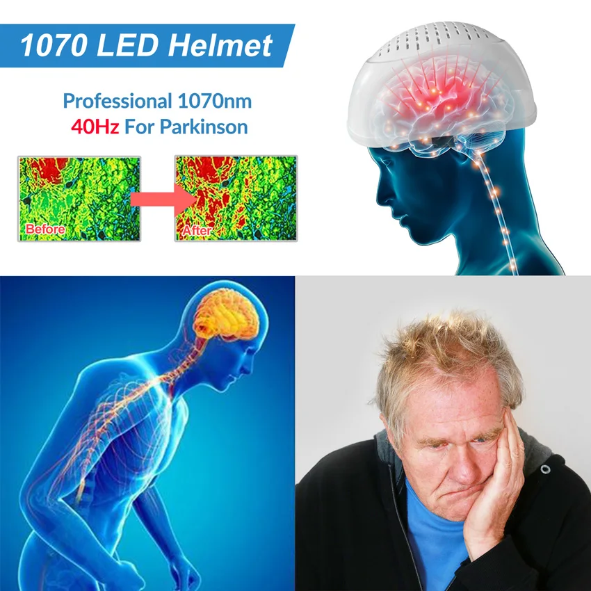 1070nm Photodynamic Near Infrared Light Therapy Brain Stimulation Photobiomodulation Helmet for Parkinsons Alzheimer Stroke