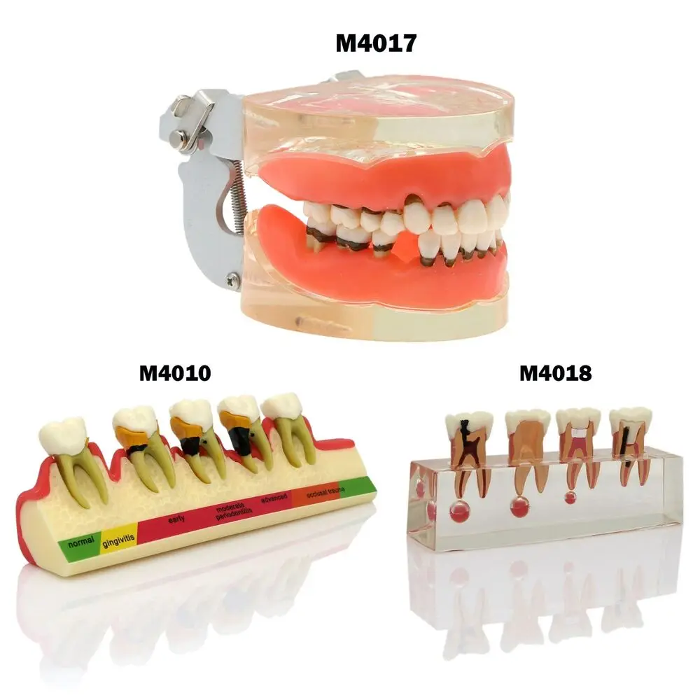 

Dental Teeth Model Pathological Typodont Endodontic Periodontal Disease Study Periodontal Disease Assort Demo