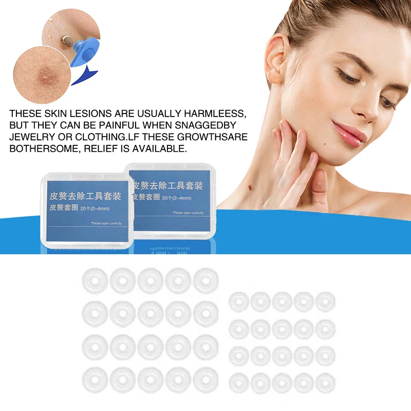 20pcs/Box Flesh Nevus Removal Bands Non-Toxic Mole Rubber Kit Wart Treat Tool Men Women Face Skin Care No Pain Safe view 6