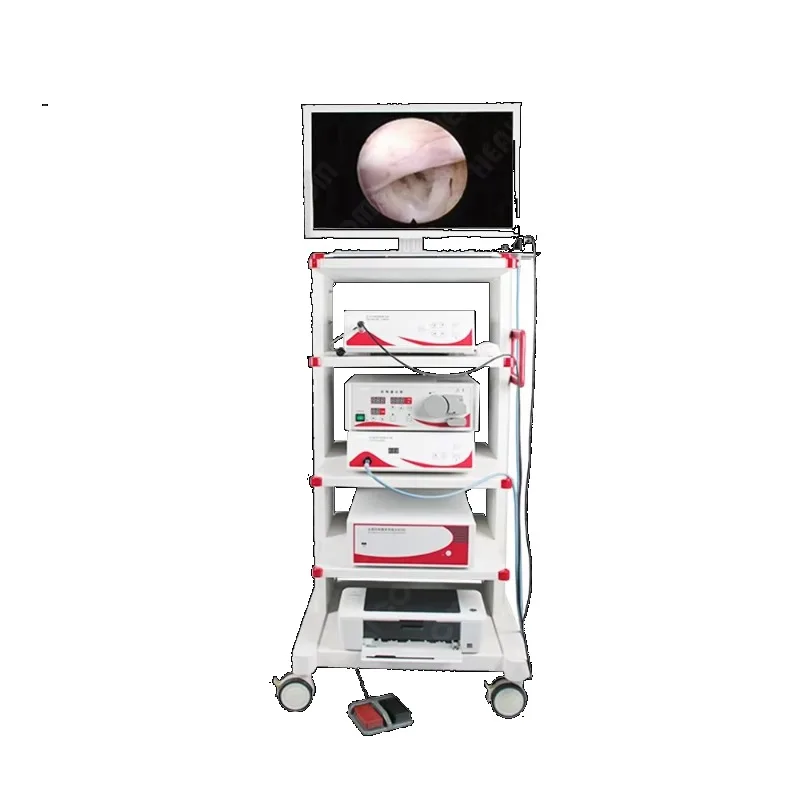 Endoscopy Tower Arthroscopic Camera System with Surgical Instruments Arthroscopy