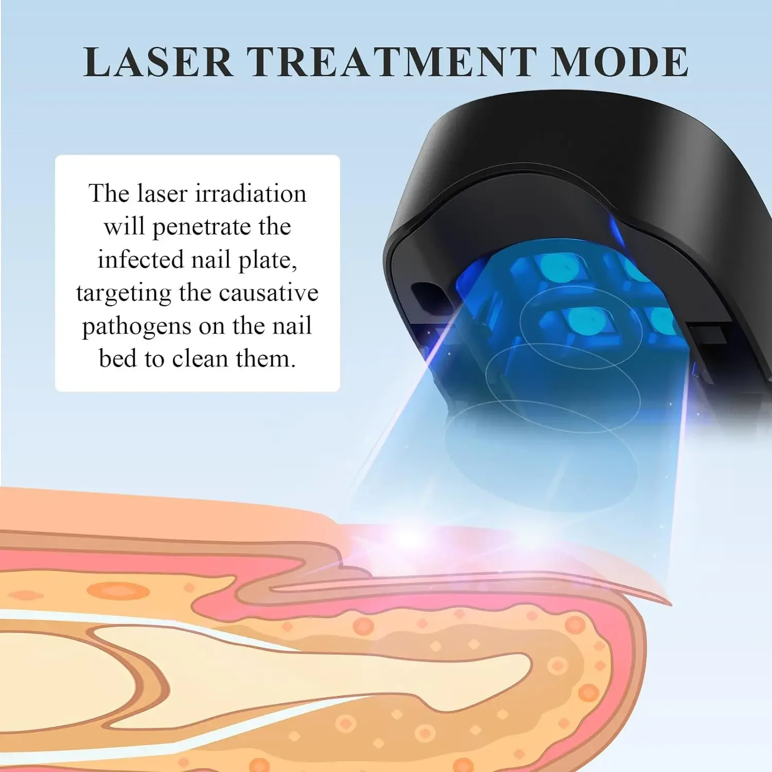 Nail Fungus Treatment Laser Device for Cleaning Onychomycosis USB Charge Anti Fungal Repair Damaged Discolored Thick Fingernails