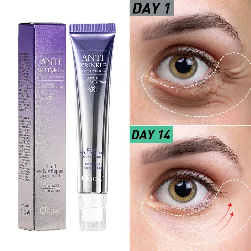 Anti Wrinkle Anti Dark Circle Eye Cream Roller Massager Moisturizing Eye Bags Anti Aging Hyaluronic Acid For Eye Use Skin Care