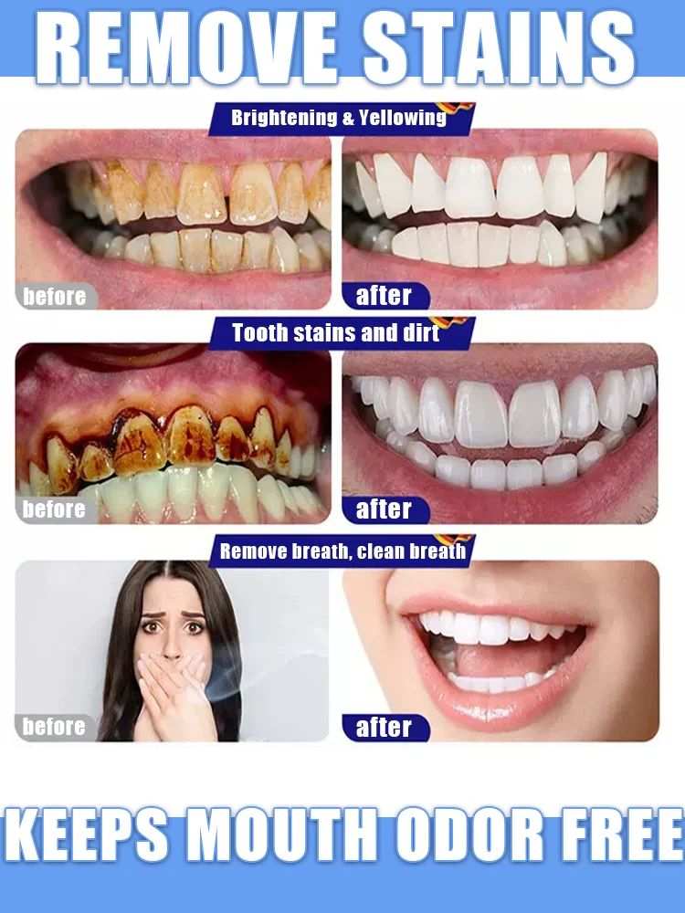 2025 waterproof intraoral repair patch, tooth correction patch, damaged and discolored intraoral care tool