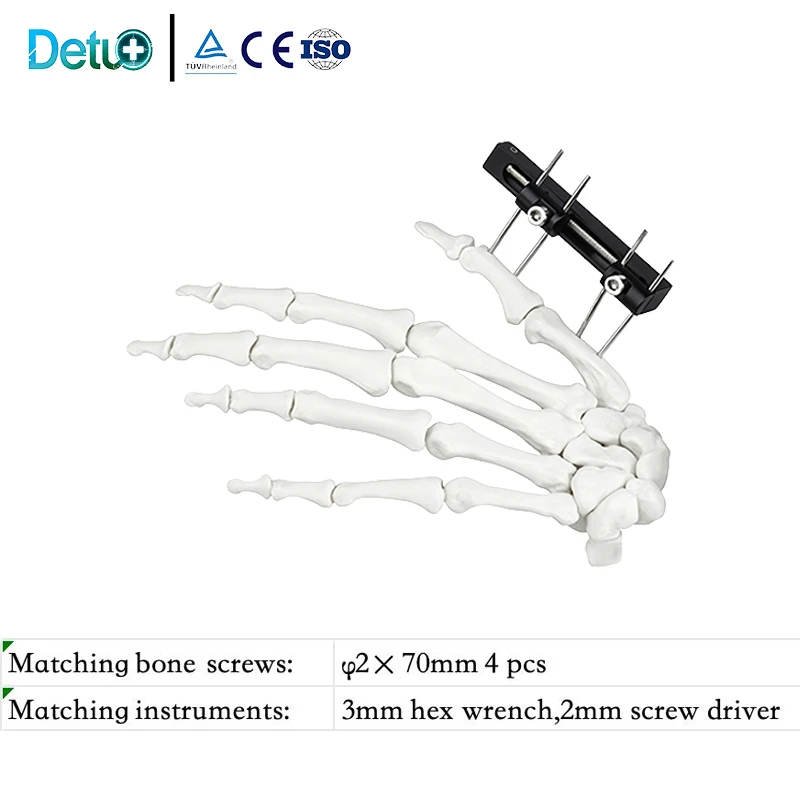 Orthopedic Mini External Fixator Small Bones Fracture Fixation Hand Finger Phalanges Metacarpal Straight Track CE Aluminum