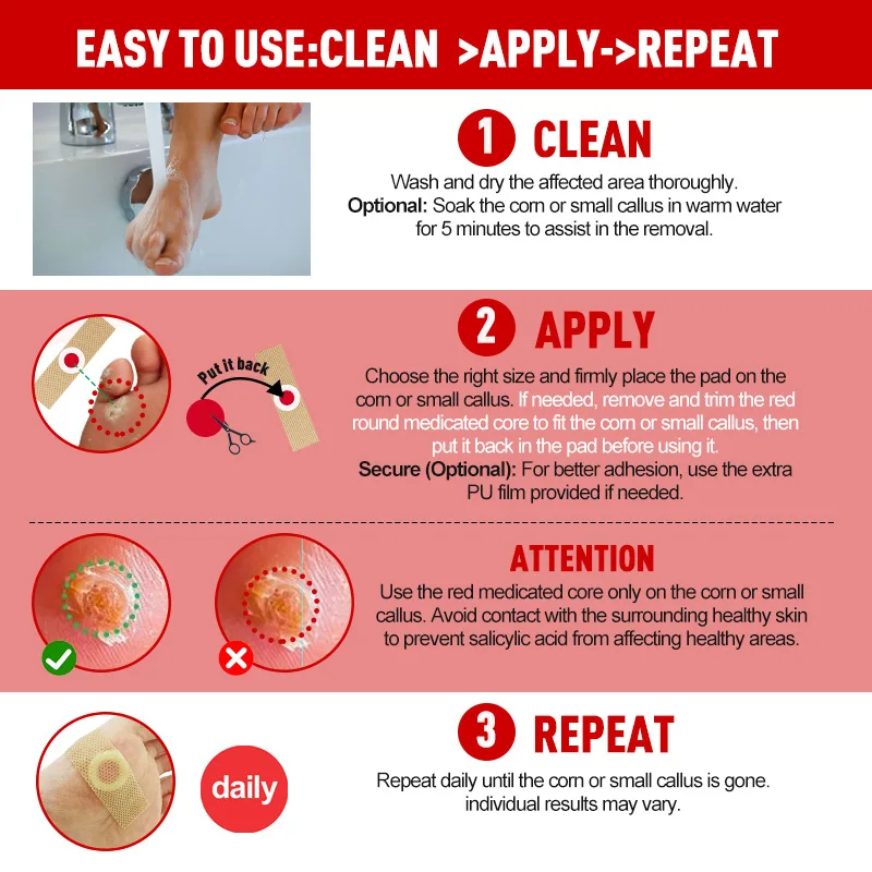 Corn Foot Toe Heel Callus Dead Skin Relief Cleaning Care Patches Adhesive Callus Cushion Non-woven Fabric Toe Corns Removal