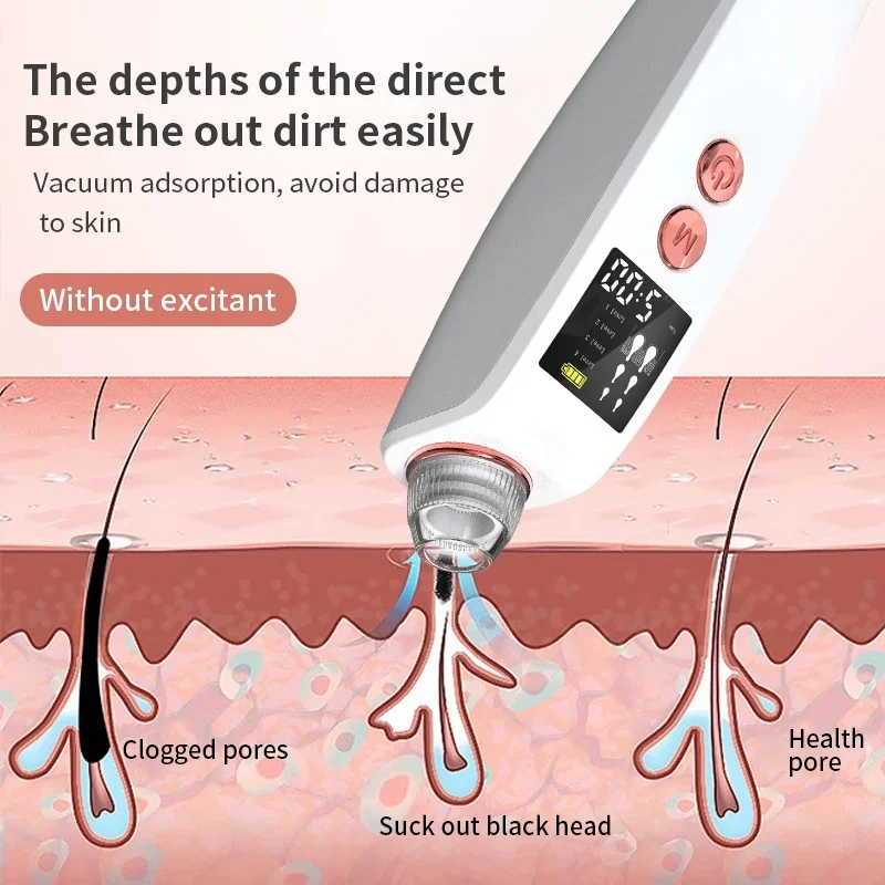 Para limpieza facial y cuidado de los poros, removedor de espinillas faciales con carga inalámbrica, herramienta de limpieza profunda de poros y cuidado de la piel