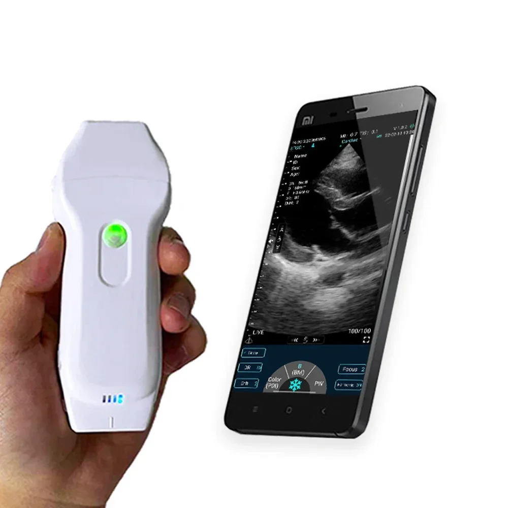 Dual 128 Wifi Ultrasound Multipurpose Linear+cardiac Ultrasound Probe for Blood Vessels, Nerves, Musculoskeletal