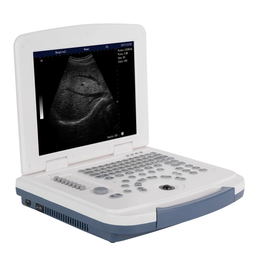 Portable Ultrasonic Diagnostic Scanner Full Digital B/W Ultrasonography Scanner