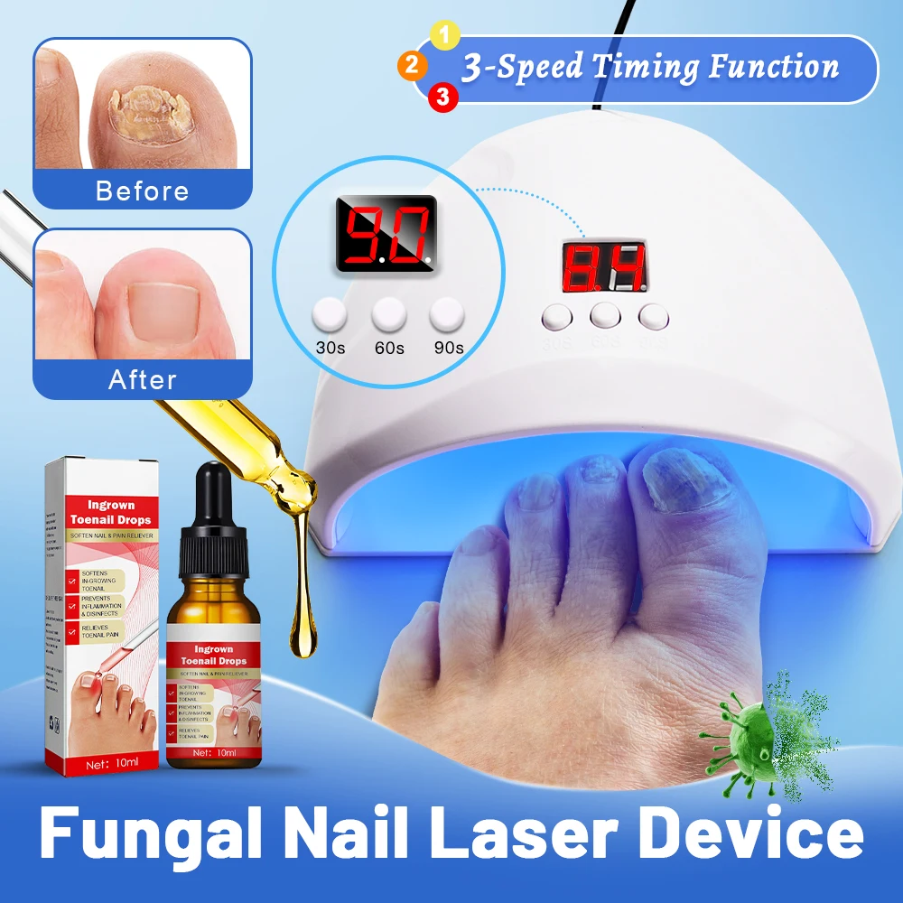 Fungal Nail Laser Device Nails Fungus Fast Repair Onychomycosis Toenail Fingernail Removes Nail Fungus Foot Care Cure Ingrown