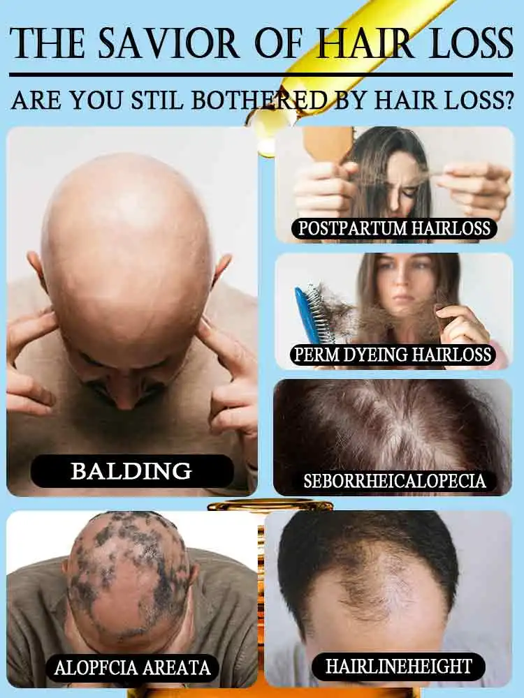 Hair Growth Solution