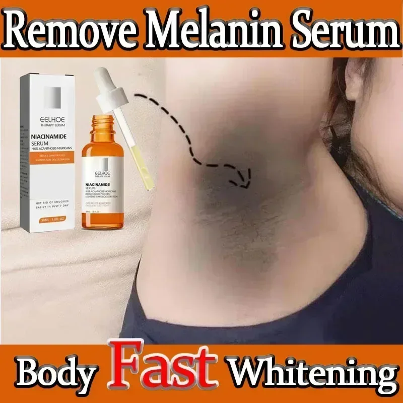 Dark knuckles whitening serum Elbows Armpit Beaching Serum Woman Private Part Skin Melanin Removal Strong Whitening Serum