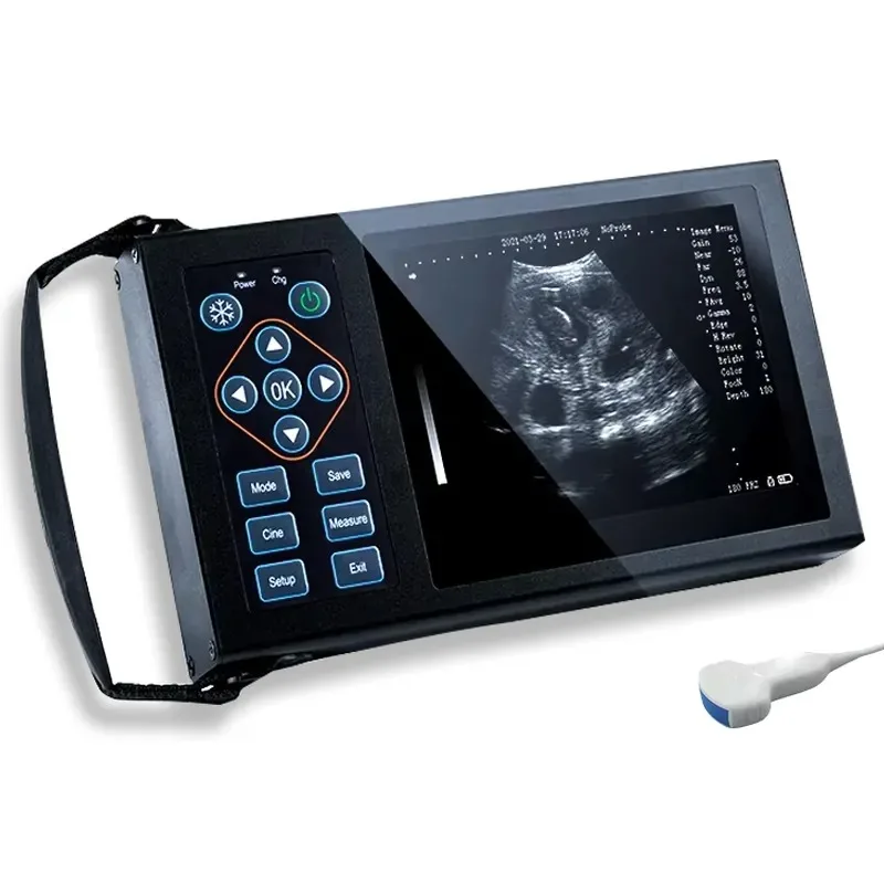 Handheld Pet Scanner With Image Storage Function for Veterinary Clinic and Mobile Farm Inspection