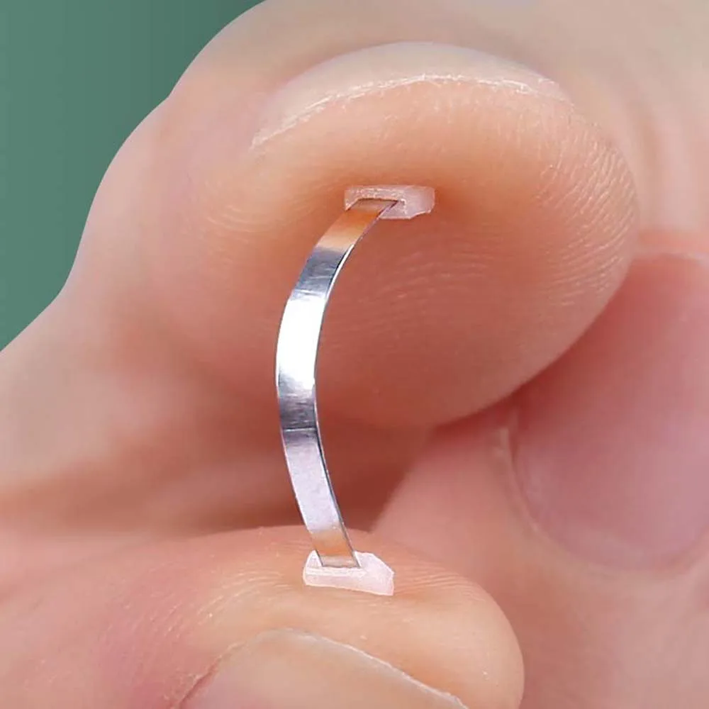 Ingrown Toenail Recover Toe Braces Pedicure Tool Bunion Corrector Ingrown Toenails Corrector Toenail Straightener Toenail Fixer