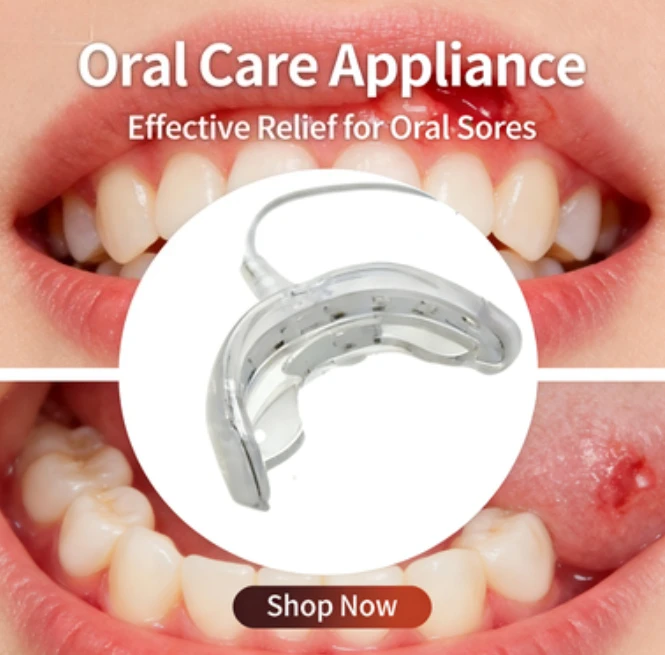 

Starlite Smile Red Light Therapy for Gum Disease Treatment Periodontal Treatment Oral Care Promotes Healing and Pain Relief