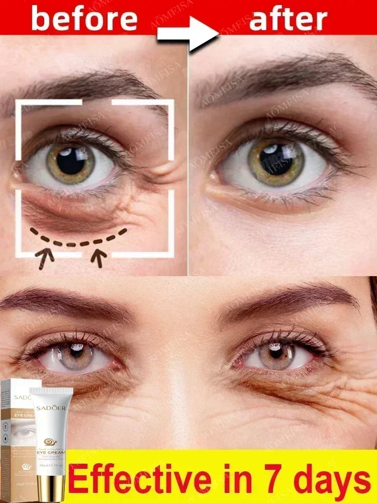 Instant Eye Bag Removal ครีมคอลลาเจน Anti-Wrinkle Fade Fine Lines กระชับผิว Anti Dark Circle Puffiness Brighten Eye Care