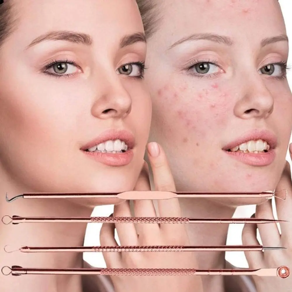 4 قطعة/المجموعة فائقة غرامة بثرة مزيل خلية كليب العميق الأنظف صالون تجميل البثرة الملقط الجلد أداة العناية بالوجه حب الشباب إبرة