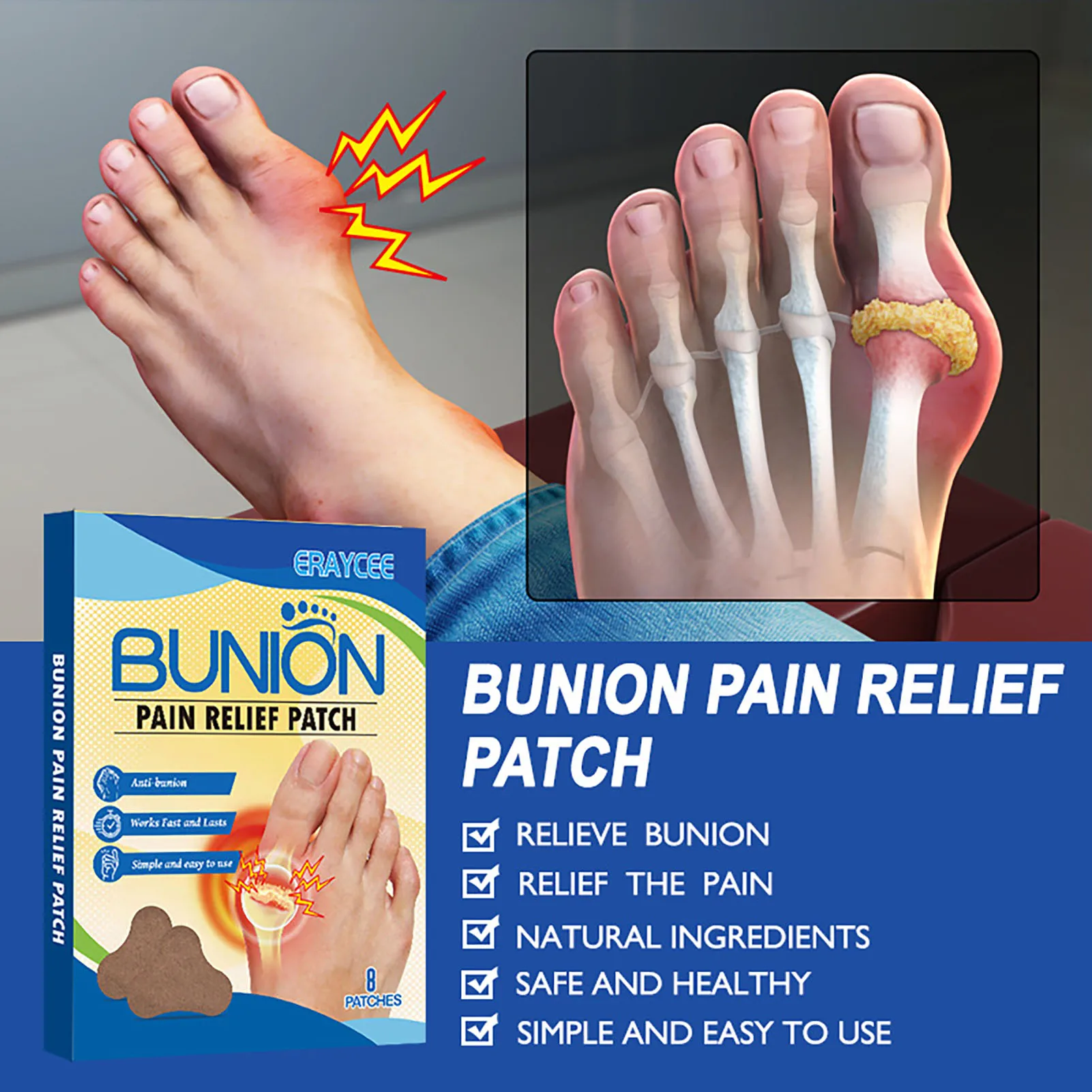 8pcs Anti Bunion Patches Bunion Corrector Toe Separator Orthopedic Straightener Foot Bunion Pain Swelling Relief Patch Foot Care