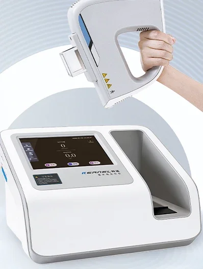 Vitiligo phototherapy instrument Household non-311uvb ultraviolet light therapy instrument 308nm excimer light