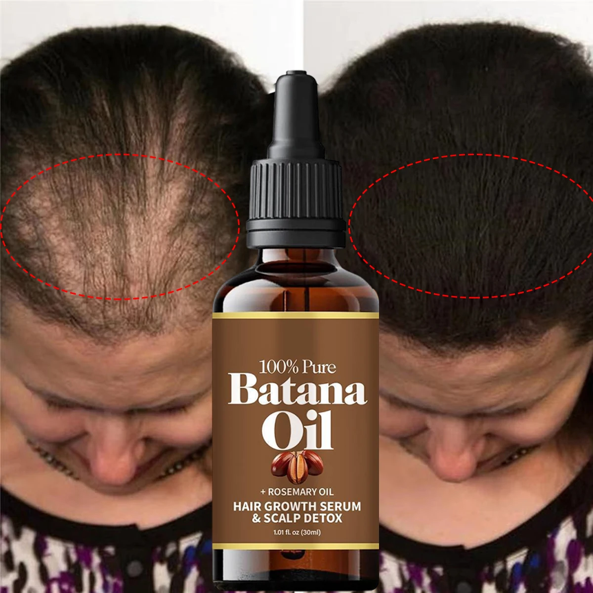 

Batana Rosemary Mint Scalp Hair Strengthening Oil Anti Hair Loss Essence Oil Health Nourishing Split Ends Dry Types Hair Care