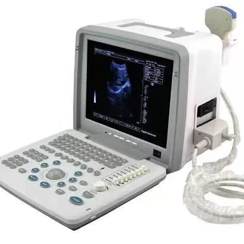 

Physiotherapy Scanning Machine Portable Black And White Ultrasound For Hospital