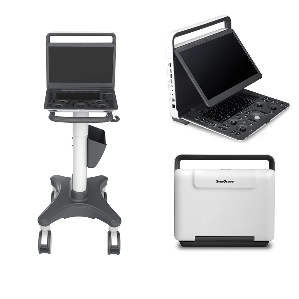 sonoscape e1 exp expert machine 4d ultrasound