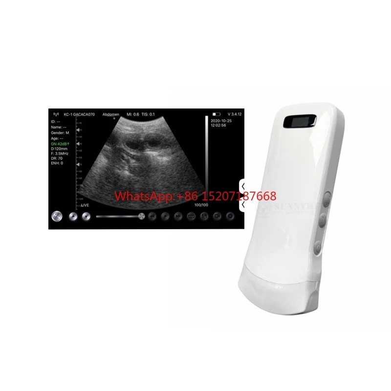 

SY-A0C1 Portable Smartphone USB WIFI Ultrasound Scanner Doppler Micro Convex Ultrasound Scanner Wifi Ultrasound