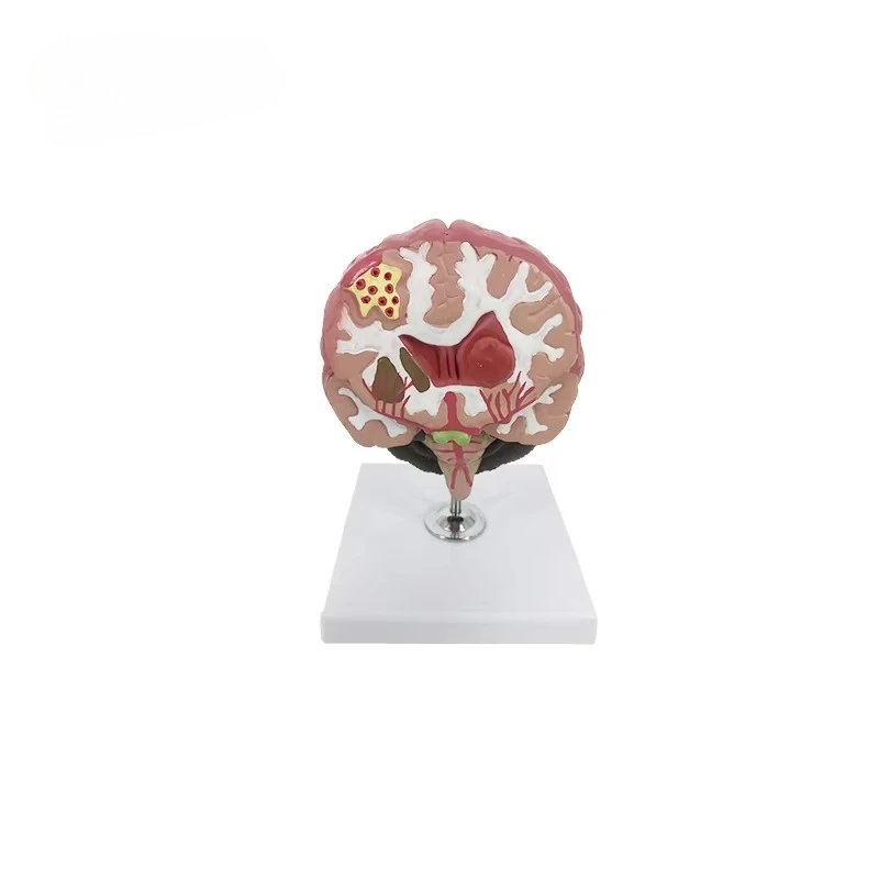 PVC Brain Pathological Anatomical Model for Medical Training