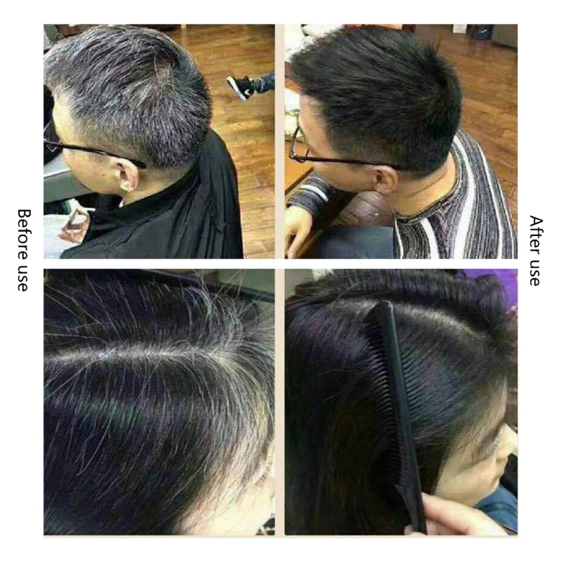 Polygonum Multiflorum – shampoing blanc à à base plantes, efficace, 300ml, livraison directe