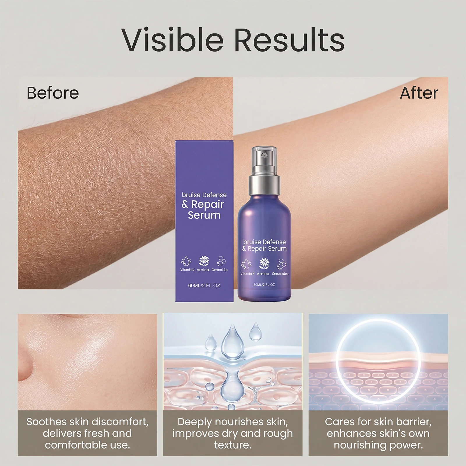 Arnika-Serum-Spray zur Linderung von Prellungen und Verletzungen, Reduziert Rötungen und Schwellungen, Verbessert Pigmentierung, Schnell Einziehendes Körperserum – Detail 8