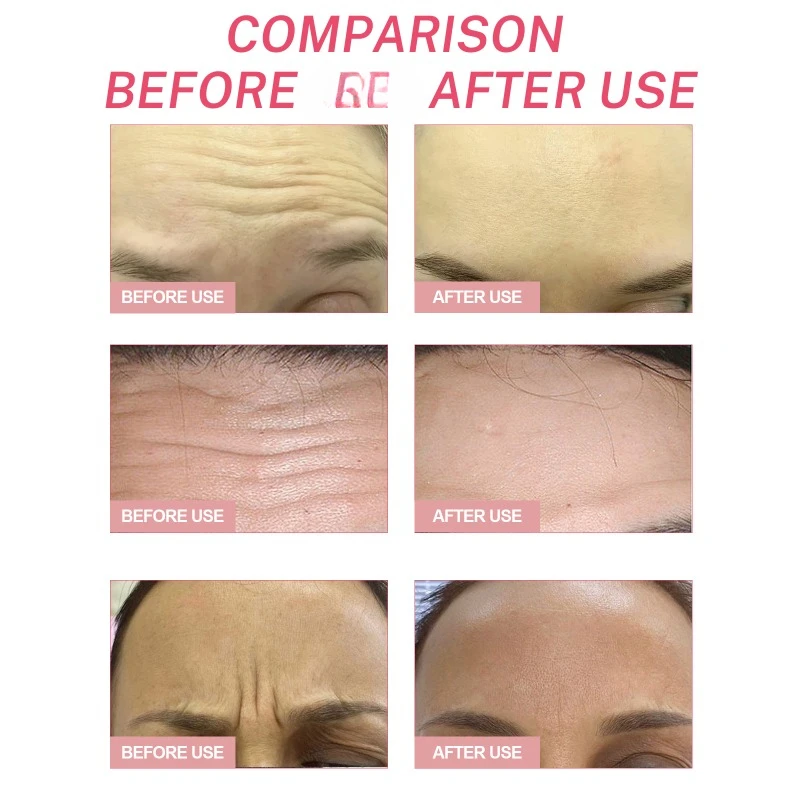 Anti-wrinkle Forehead Line Removal Patch fade fine lines Firming Frown Lines Face Skin Care Anti-aging Between Eyes Stickers