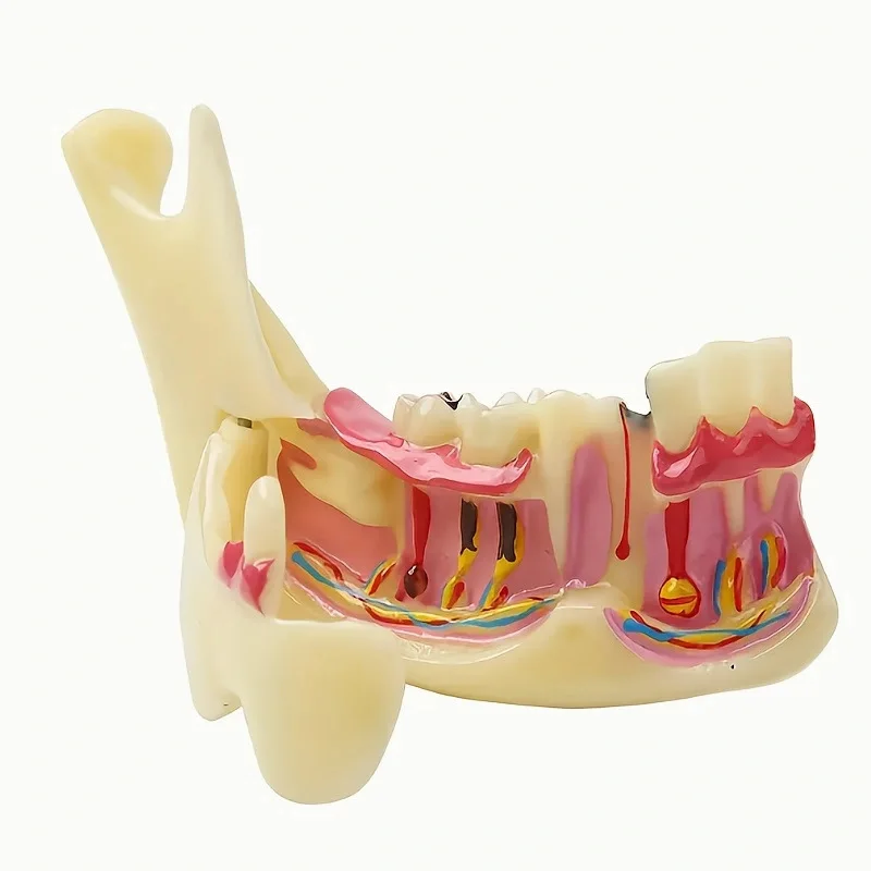 

Обучающая модель разложения нижней кости, демонстрация зубных щелочных зубов, модель стоматологического эндодонтического лечения