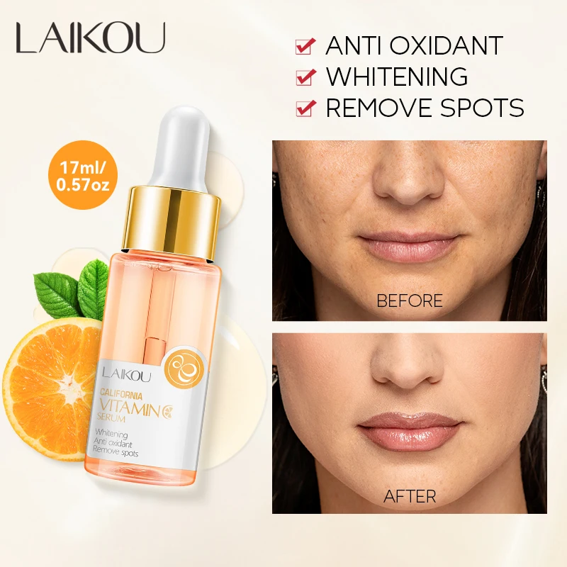 LAIKOU Vitamin C Serum 17ml Fade Spots Whitening VC Essence Brightening Facial Serum