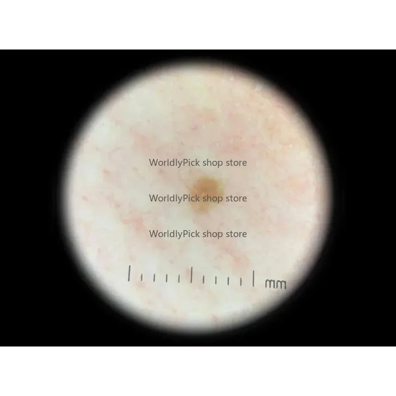 Najlepiej sprzedający się kieszonkowy dermatoskop polaryzacyjny z metalową obudową, oświetleniem LED, 2 trybami pracy, ręczny dermatoskop kliniczny, zasilany.